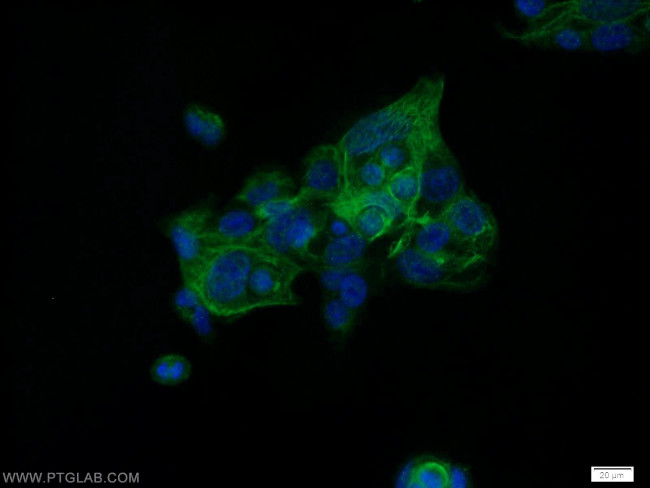 HIC5 Antibody in Immunocytochemistry (ICC/IF)