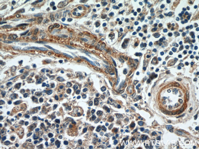 HIC5 Antibody in Immunohistochemistry (Paraffin) (IHC (P))