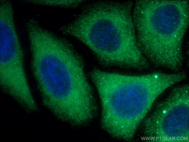 GYS1 Antibody in Immunocytochemistry (ICC/IF)