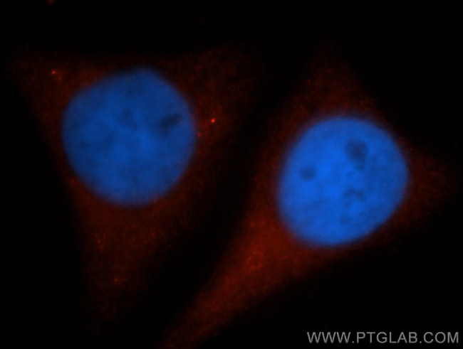 GYS1 Antibody in Immunocytochemistry (ICC/IF)