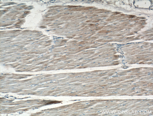 GYS1 Antibody in Immunohistochemistry (Paraffin) (IHC (P))