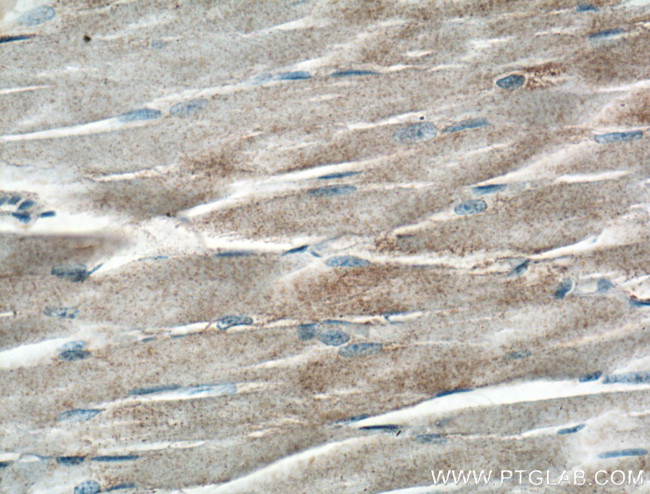 GYS1 Antibody in Immunohistochemistry (Paraffin) (IHC (P))