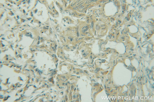 GYS1 Antibody in Immunohistochemistry (Paraffin) (IHC (P))