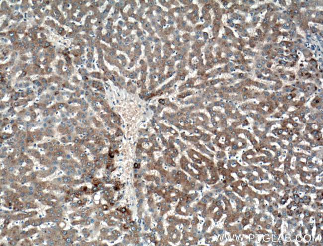 GYS1 Antibody in Immunohistochemistry (Paraffin) (IHC (P))