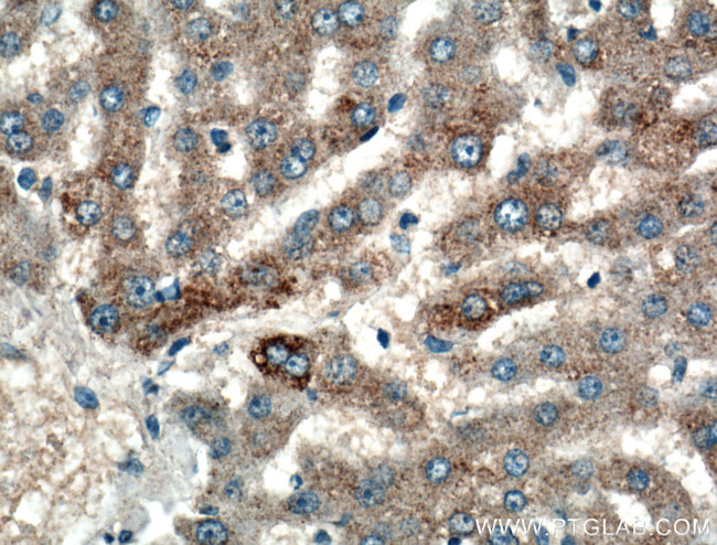 GYS1 Antibody in Immunohistochemistry (Paraffin) (IHC (P))