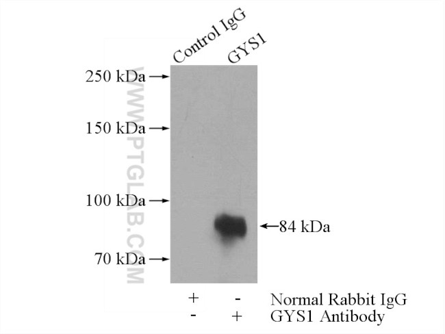 GYS1 Antibody in Immunoprecipitation (IP)