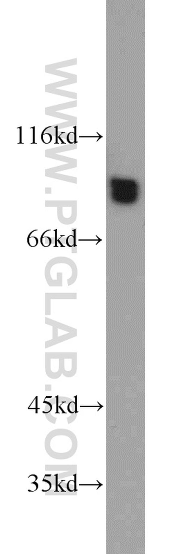 GYS1 Antibody in Western Blot (WB)