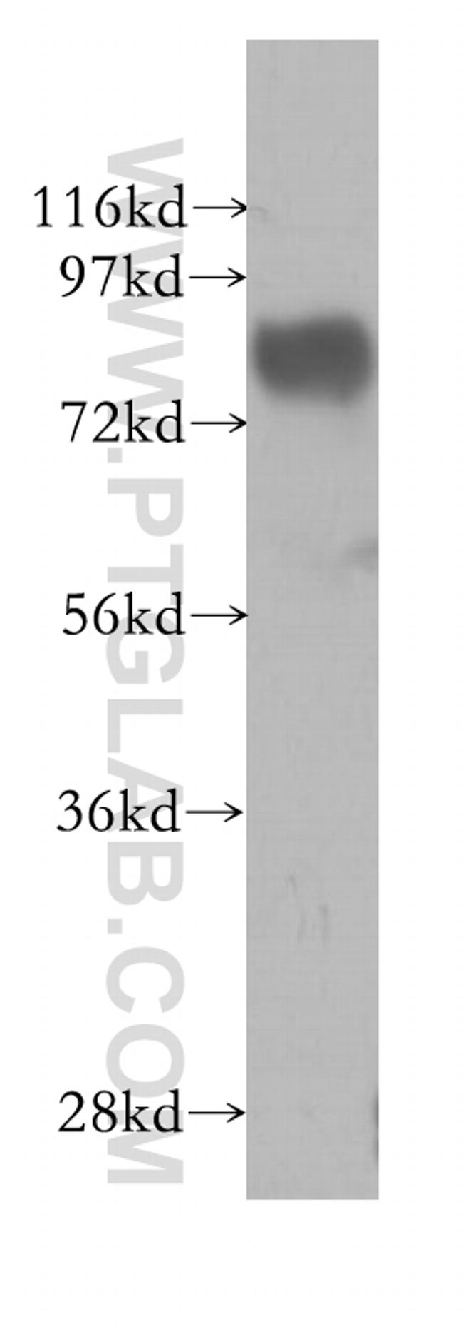 GYS1 Antibody in Western Blot (WB)