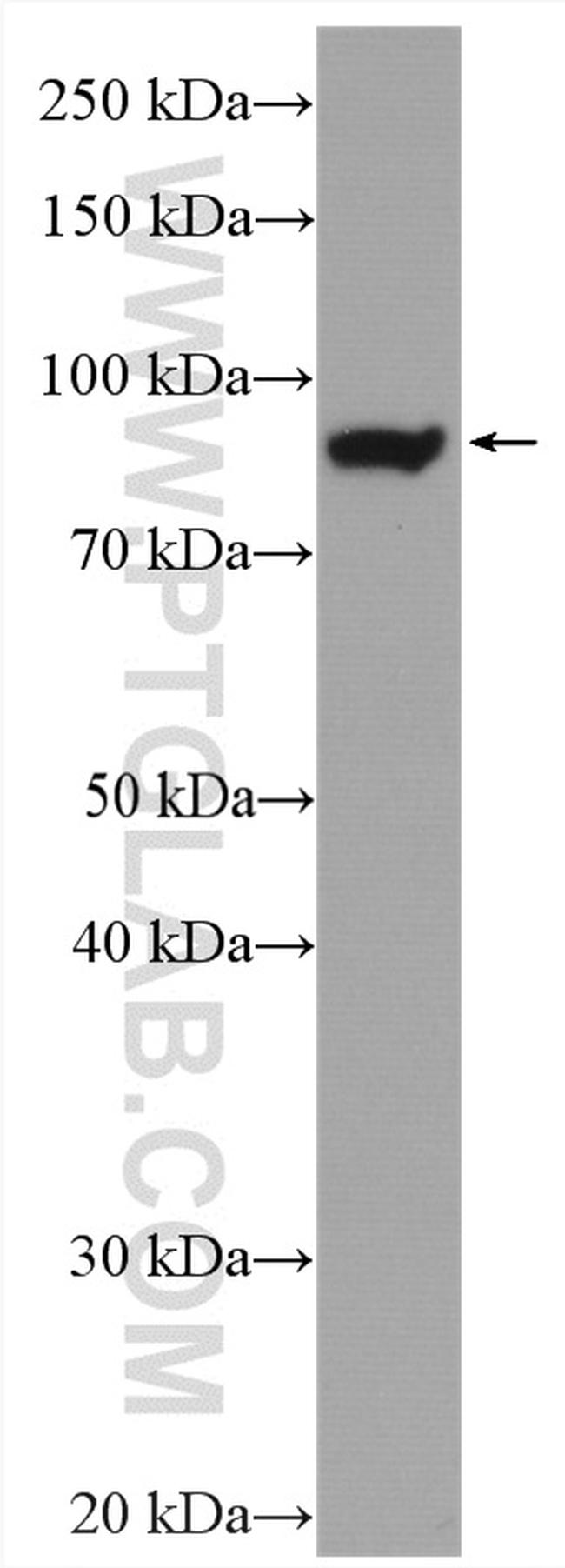 GYS1 Antibody in Western Blot (WB)