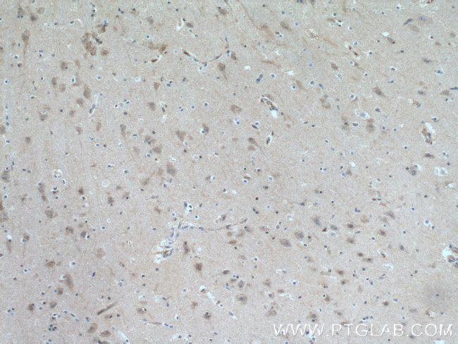 ITPK1 Antibody in Immunohistochemistry (Paraffin) (IHC (P))