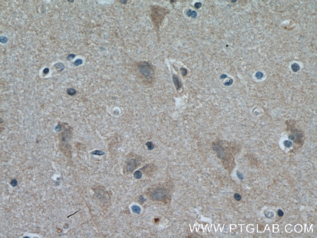 ITPK1 Antibody in Immunohistochemistry (Paraffin) (IHC (P))