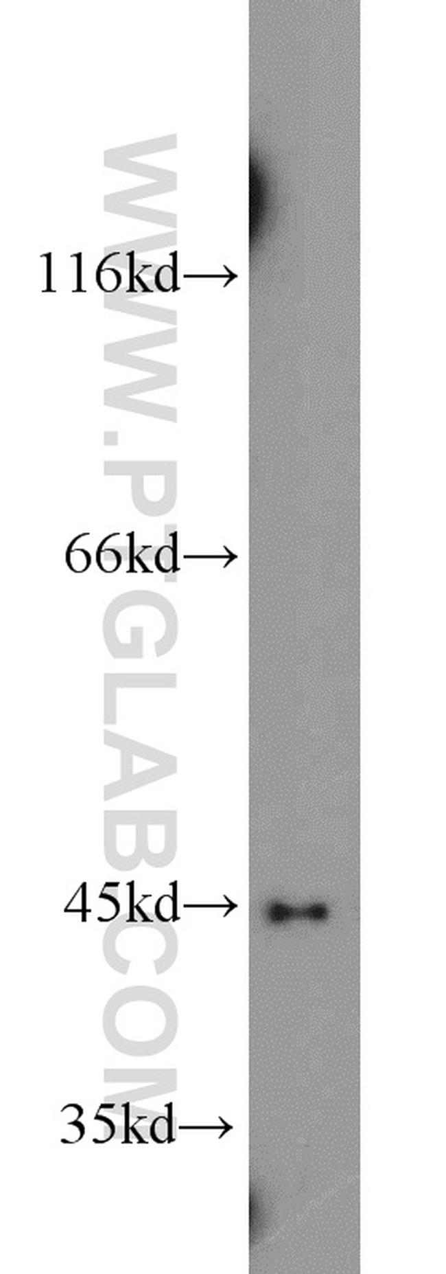 ITPK1 Antibody in Western Blot (WB)