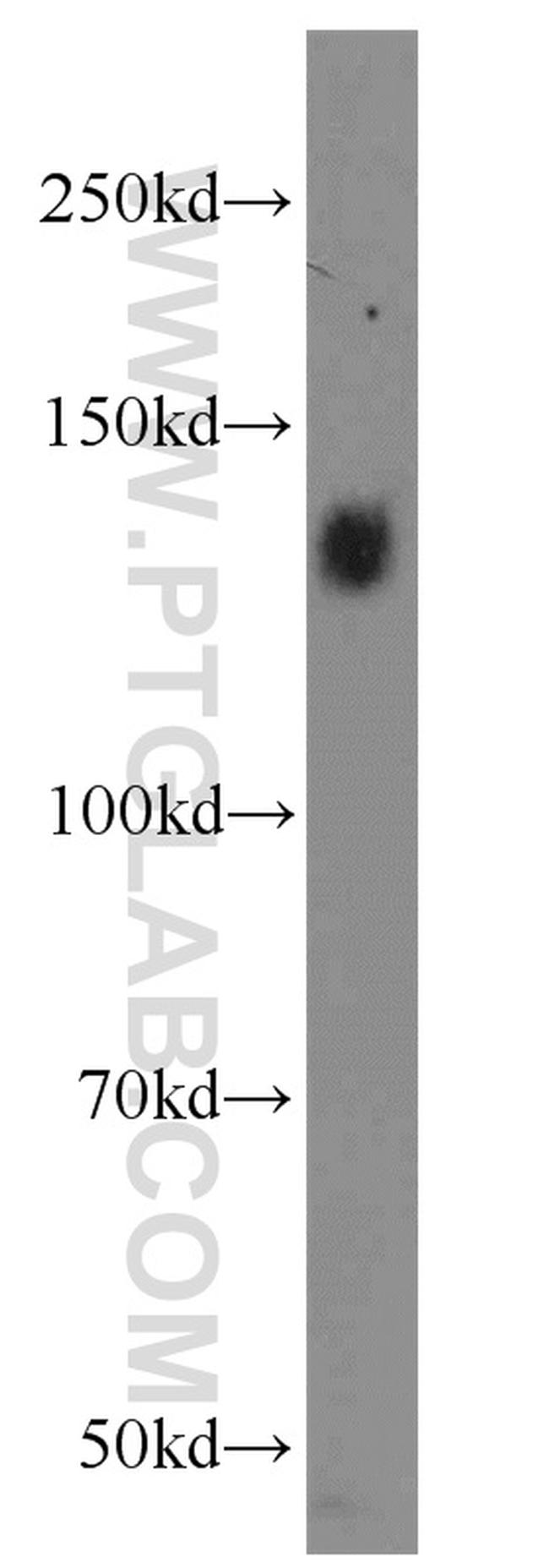 Integrin alpha-5 Antibody in Western Blot (WB)