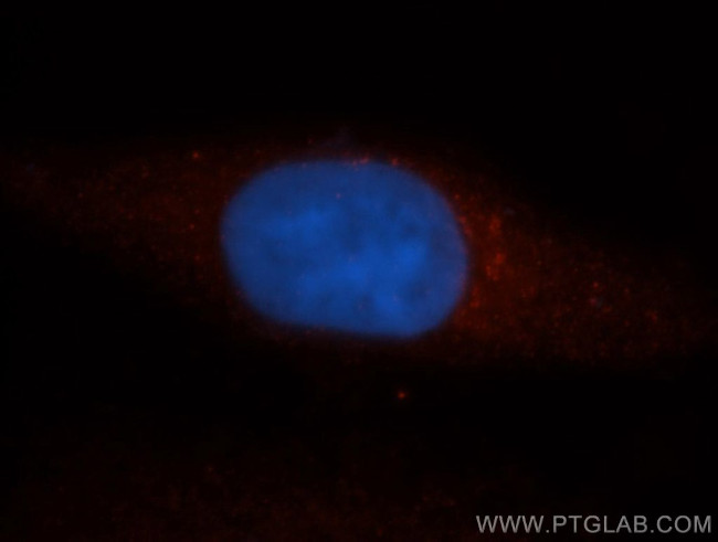 CCT3 Antibody in Immunocytochemistry (ICC/IF)