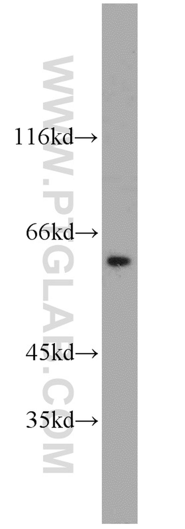 CCT3 Antibody in Western Blot (WB)