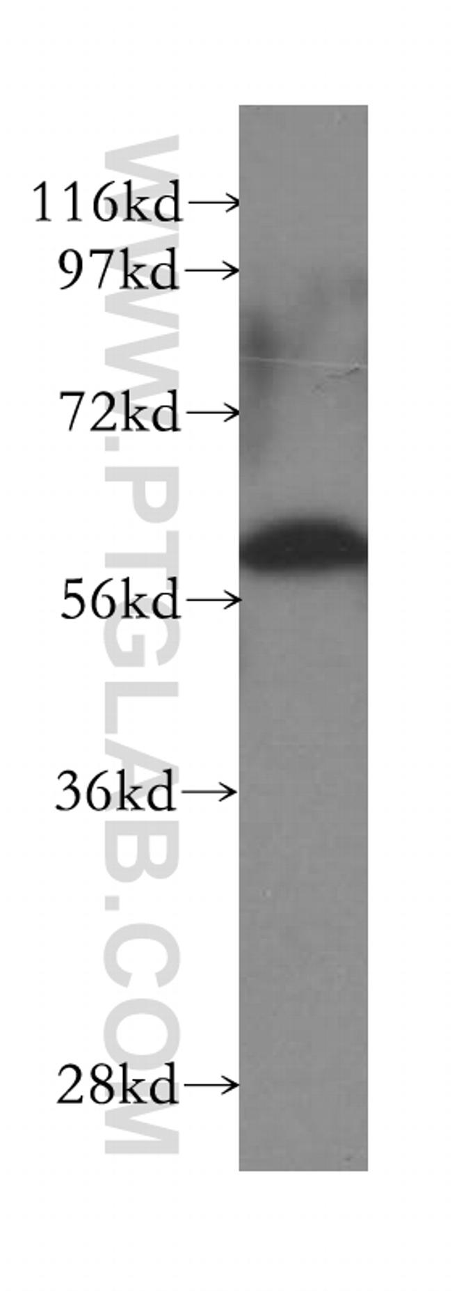 CCT3 Antibody in Western Blot (WB)