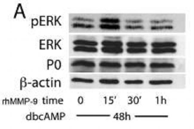 MPZ/P0 Antibody in Western Blot (WB)