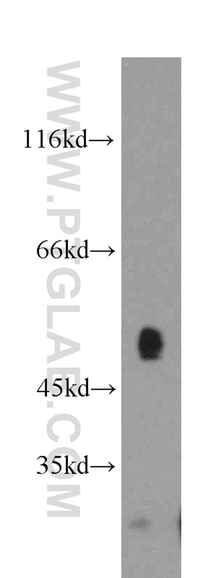 SUV39H1 Antibody in Western Blot (WB)