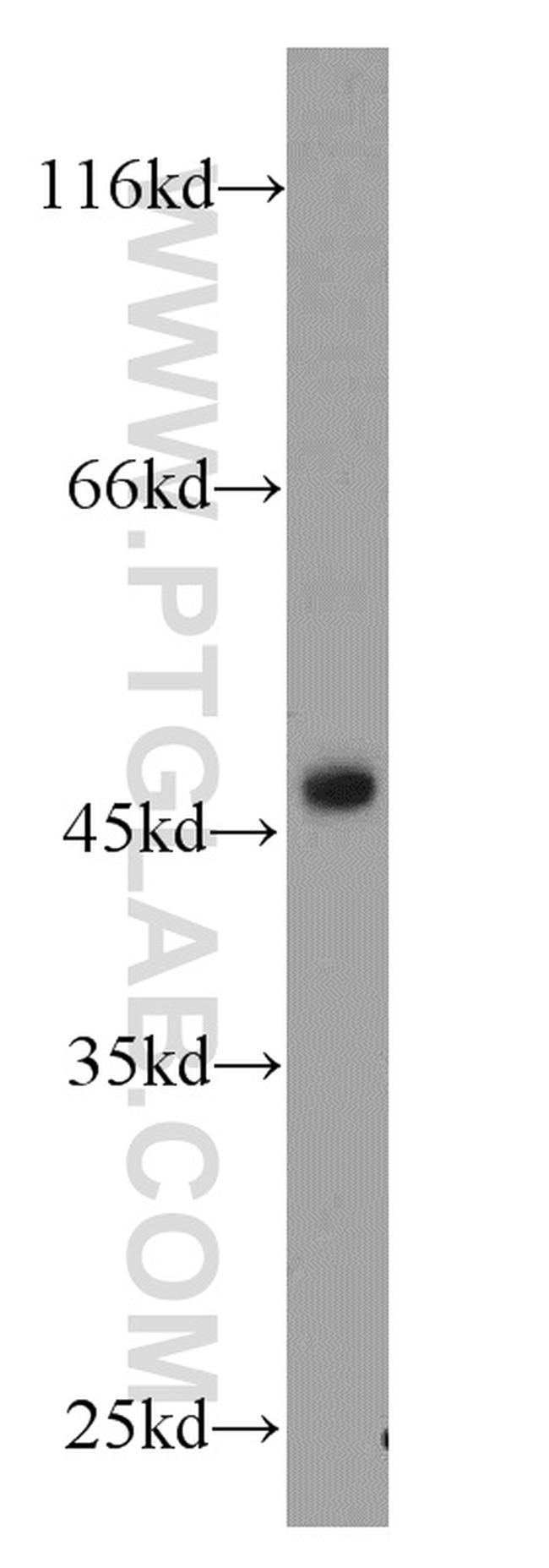 SUV39H1 Antibody in Western Blot (WB)