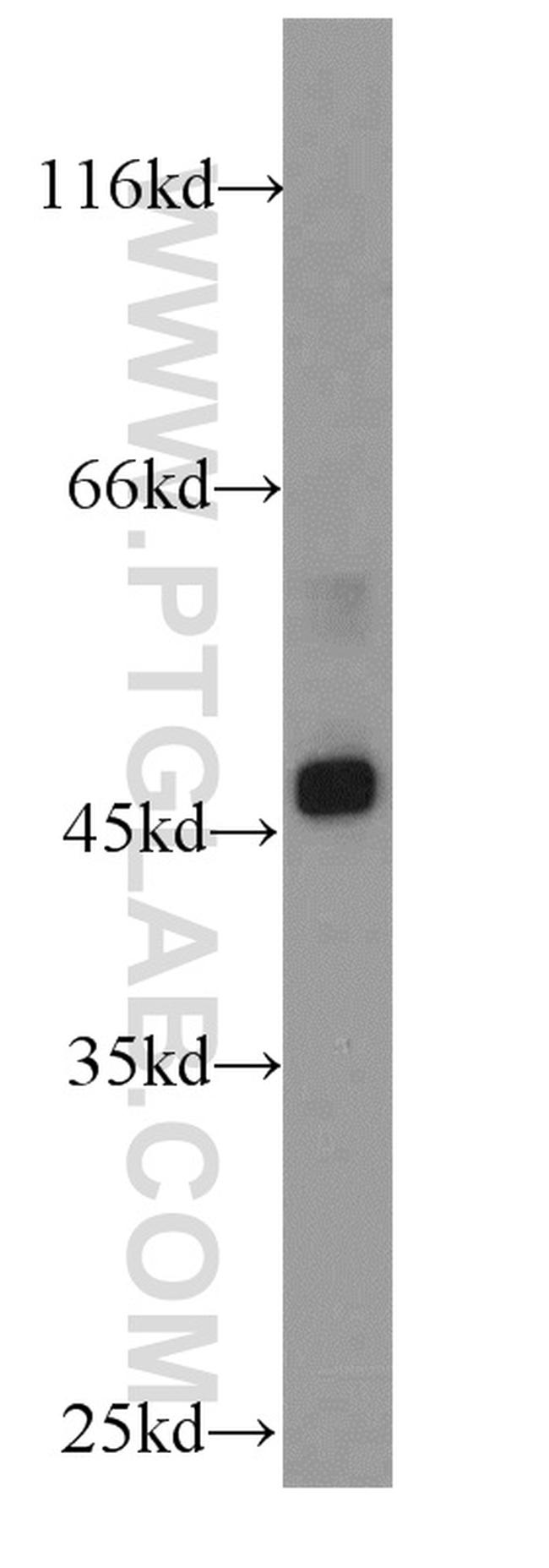 SUV39H1 Antibody in Western Blot (WB)