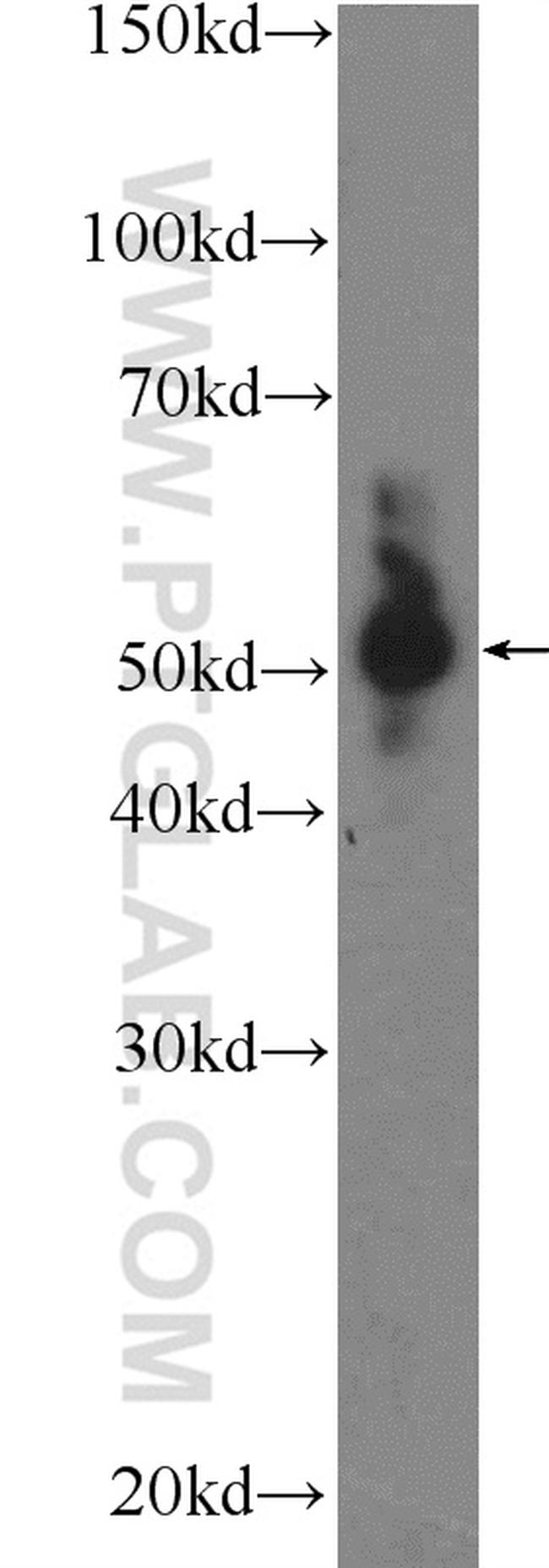 SUV39H1 Antibody in Western Blot (WB)