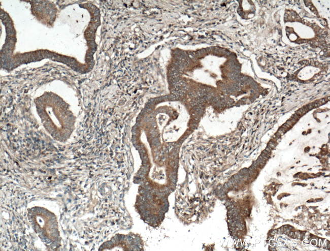 RKIP Antibody in Immunohistochemistry (Paraffin) (IHC (P))