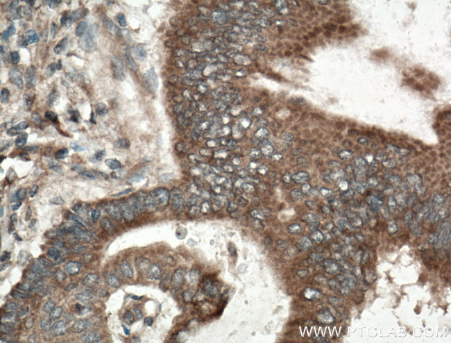 RKIP Antibody in Immunohistochemistry (Paraffin) (IHC (P))