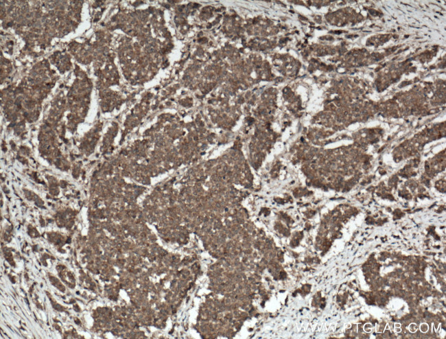 RKIP Antibody in Immunohistochemistry (Paraffin) (IHC (P))