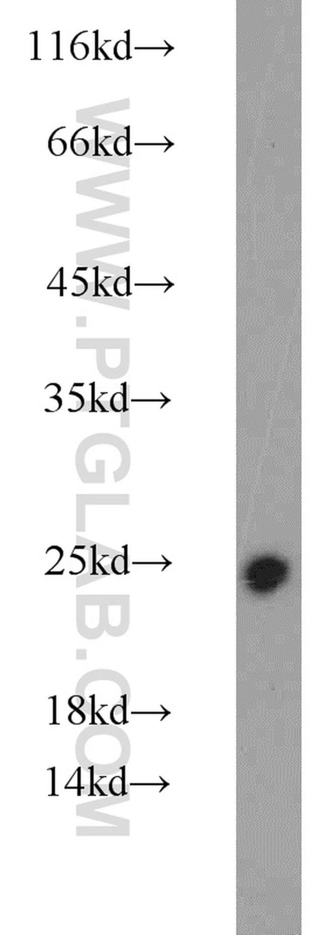 RKIP Antibody in Western Blot (WB)