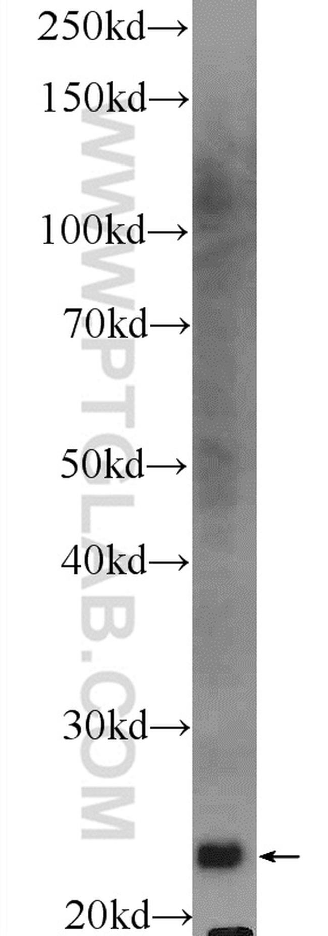 RKIP Antibody in Western Blot (WB)