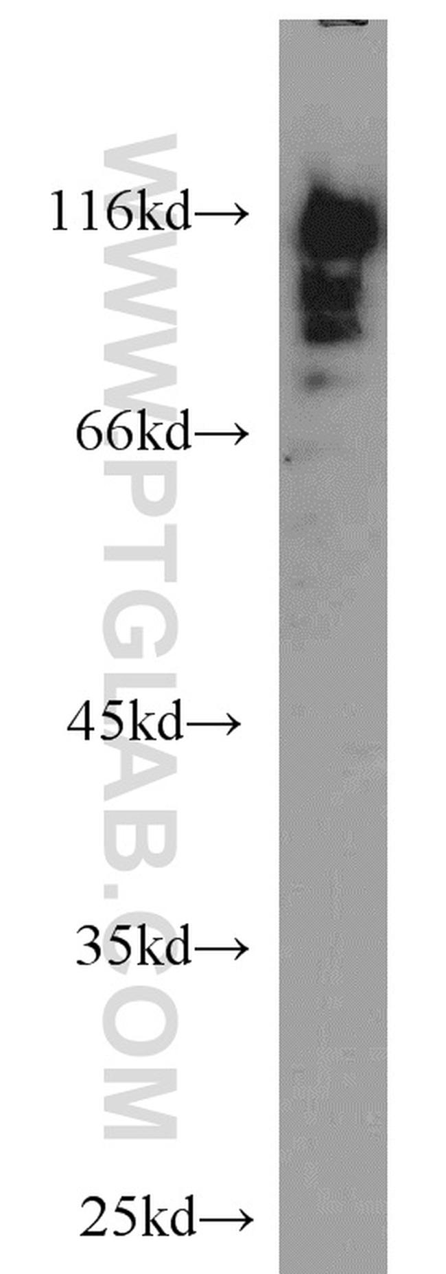 HNRNPUL1 Antibody in Western Blot (WB)