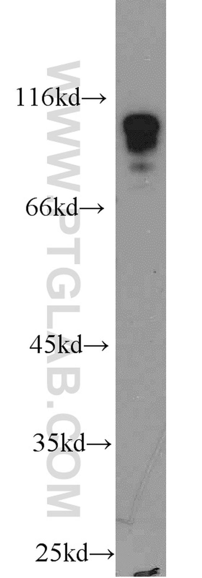 HNRNPUL1 Antibody in Western Blot (WB)