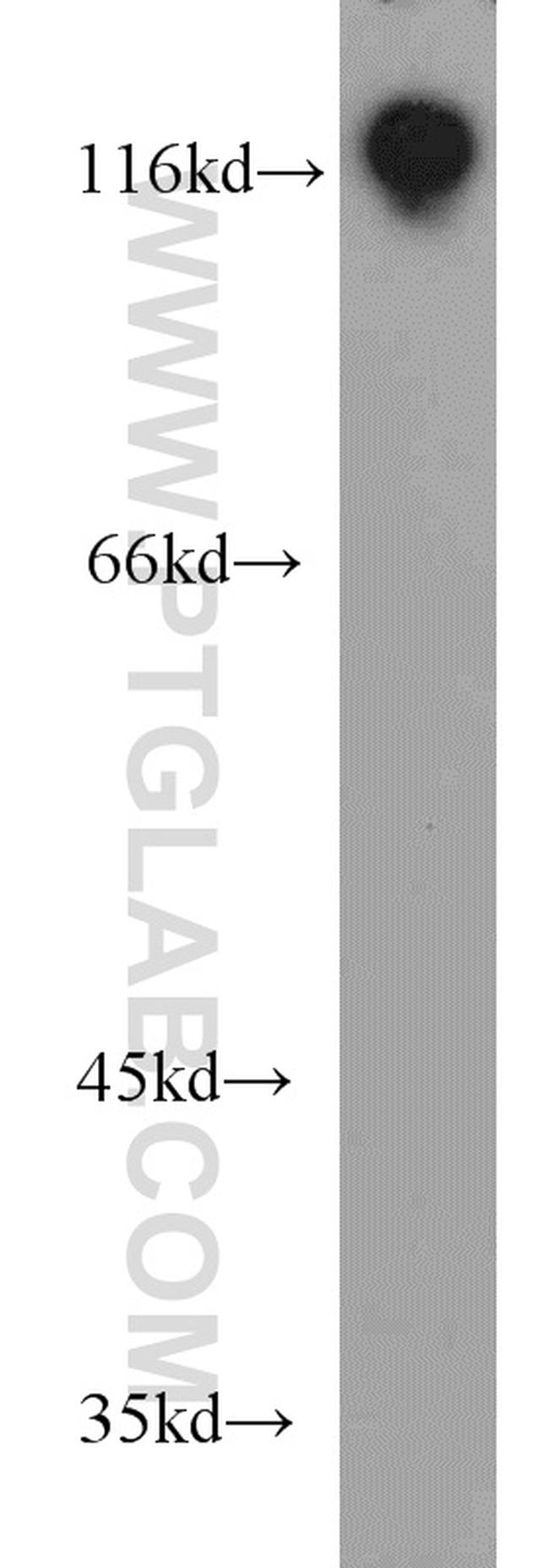 HNRNPUL1 Antibody in Western Blot (WB)