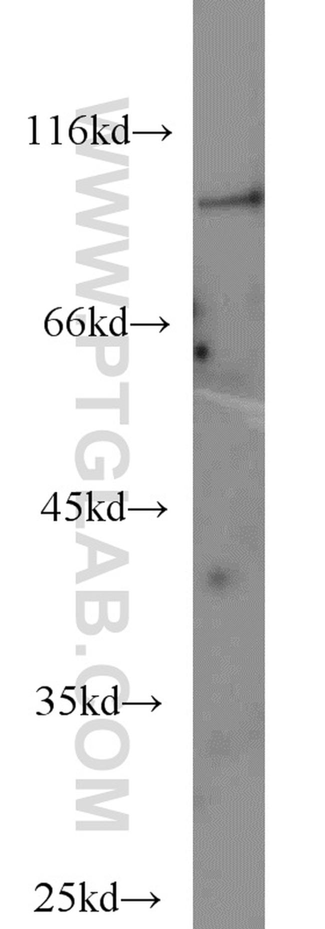 ERCC3 Antibody in Western Blot (WB)