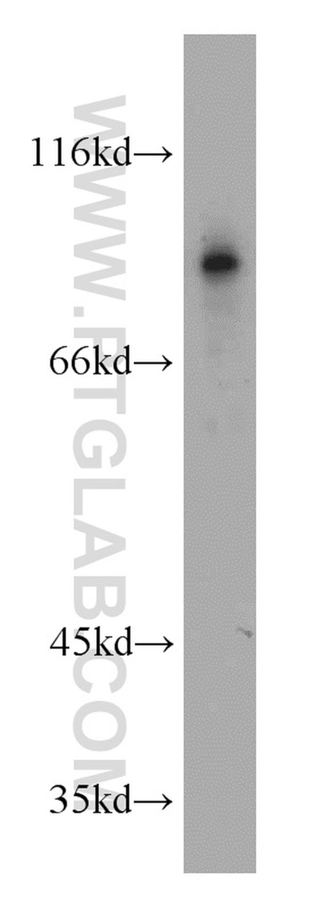 ERCC3 Antibody in Western Blot (WB)