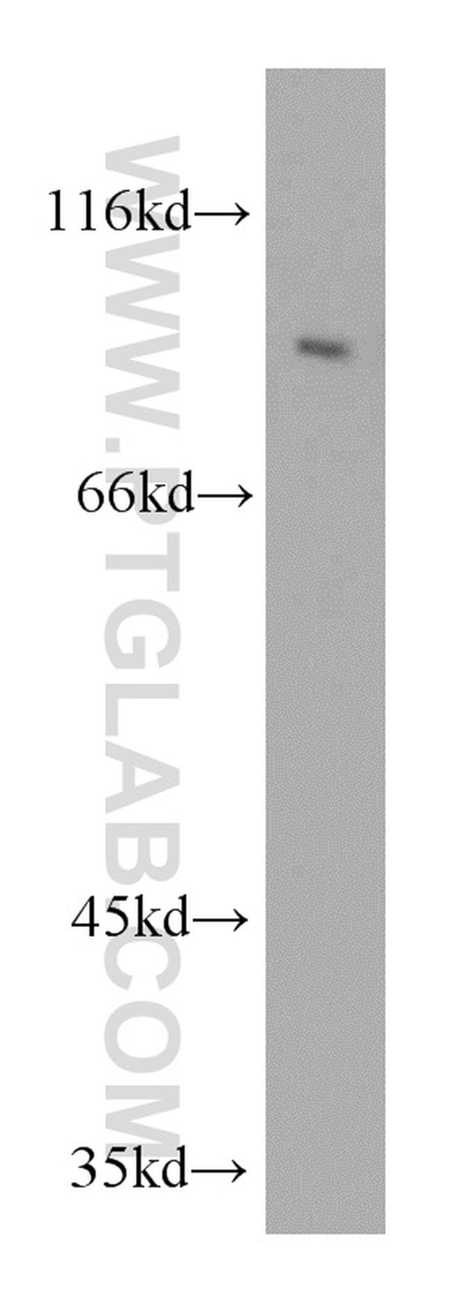 ERCC3 Antibody in Western Blot (WB)