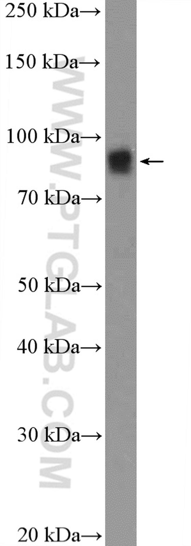 ERCC3 Antibody in Western Blot (WB)