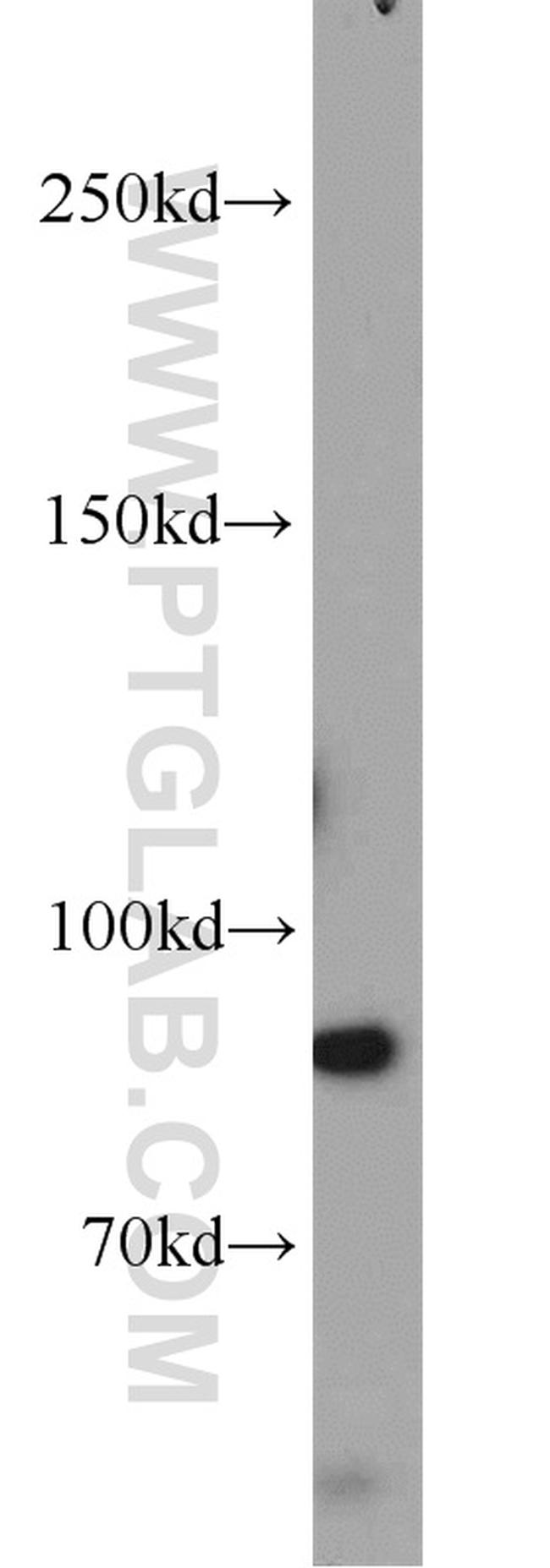 ERCC3 Antibody in Western Blot (WB)