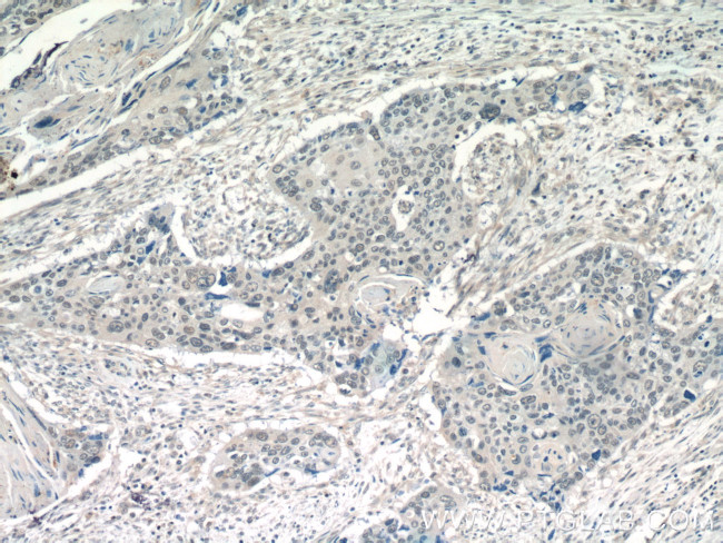 POT1 Antibody in Immunohistochemistry (Paraffin) (IHC (P))