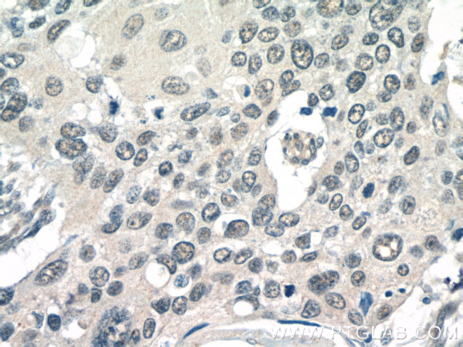 POT1 Antibody in Immunohistochemistry (Paraffin) (IHC (P))