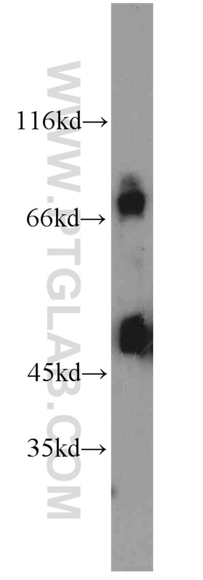 POT1 Antibody in Western Blot (WB)