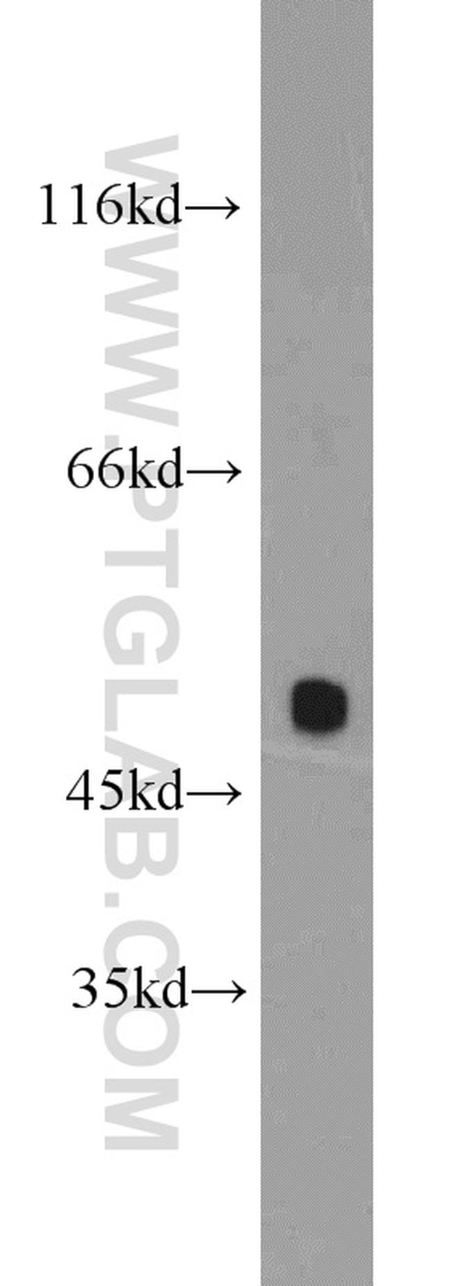 POT1 Antibody in Western Blot (WB)