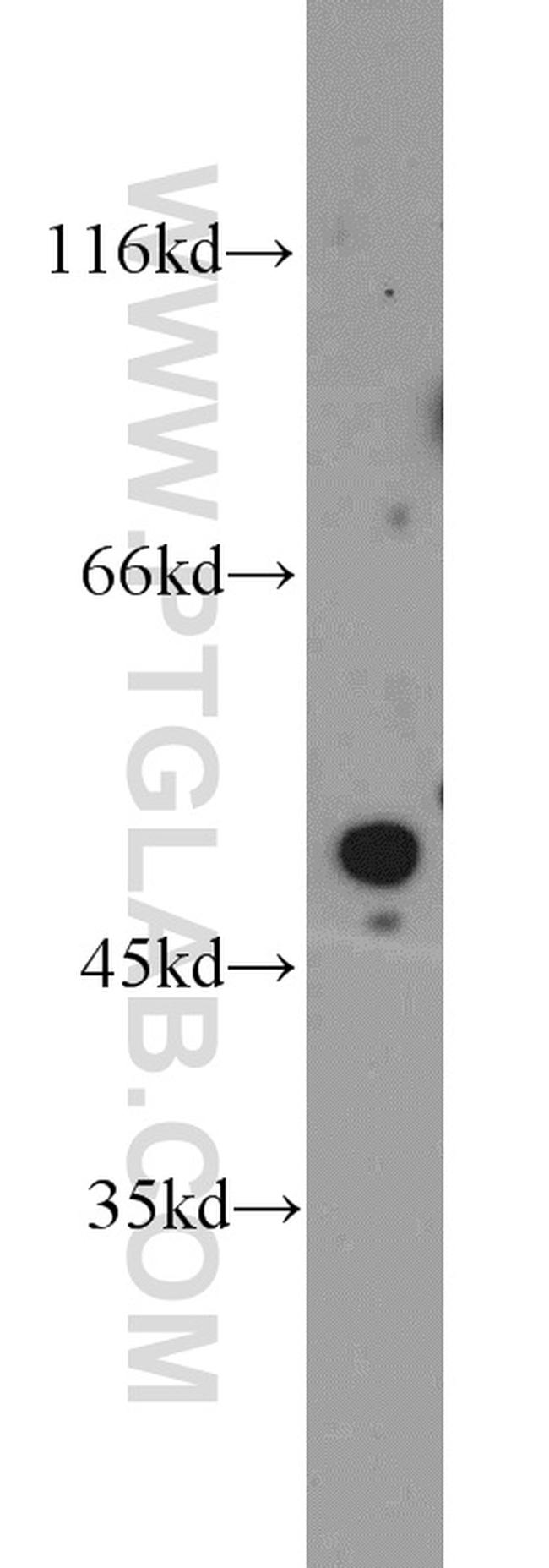 POT1 Antibody in Western Blot (WB)