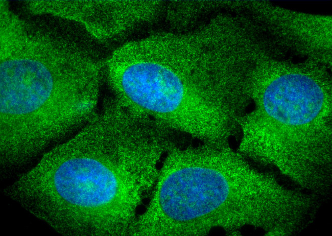 PELO Antibody in Immunocytochemistry (ICC/IF)