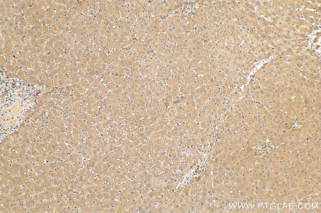 PELO Antibody in Immunohistochemistry (Paraffin) (IHC (P))