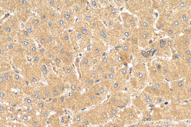 PELO Antibody in Immunohistochemistry (Paraffin) (IHC (P))