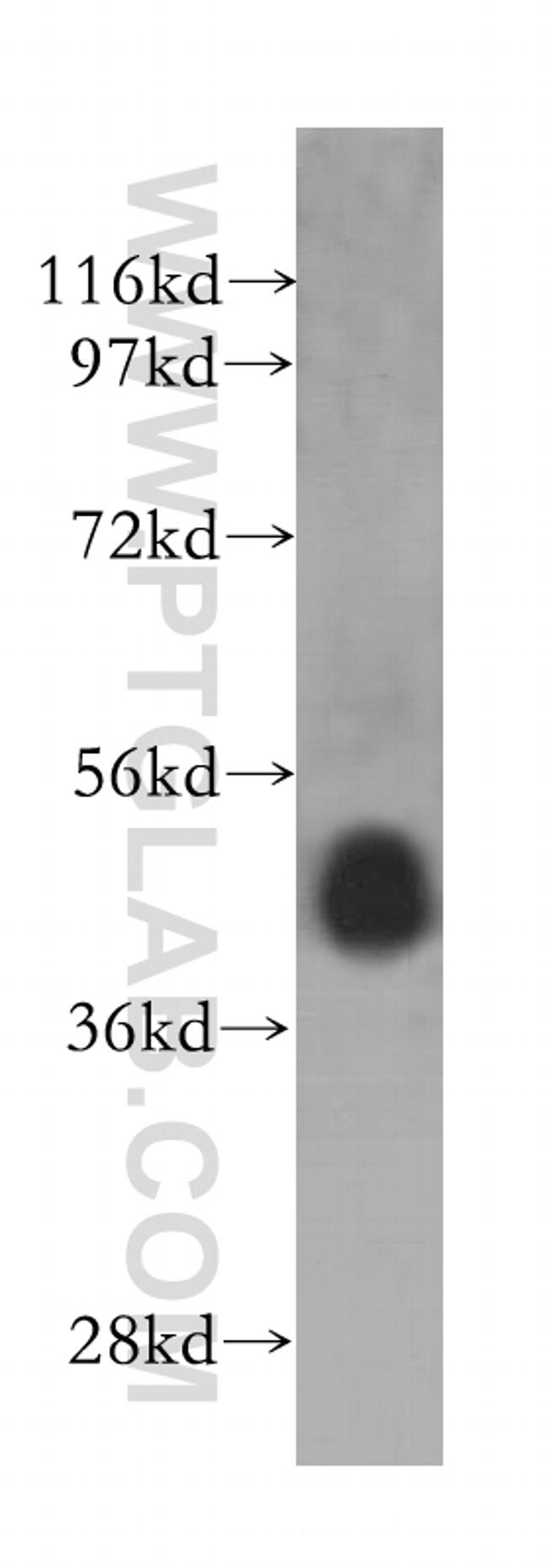 PELO Antibody in Western Blot (WB)