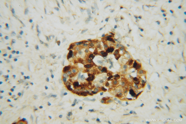 IA-2/PTPRN Antibody in Immunohistochemistry (Paraffin) (IHC (P))