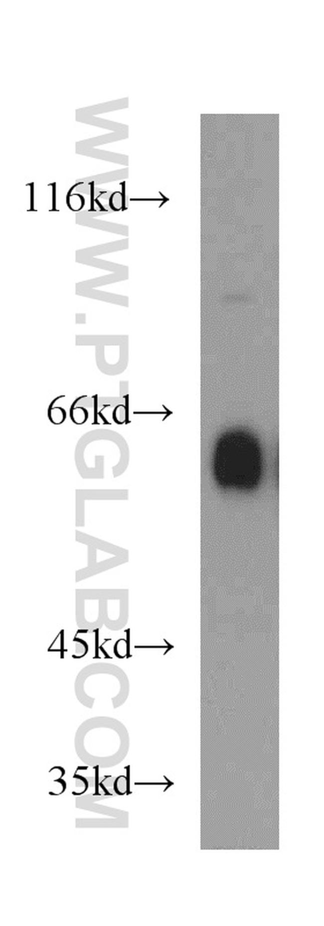 IA-2/PTPRN Antibody in Western Blot (WB)