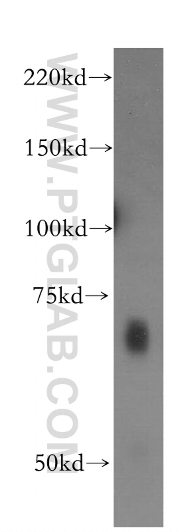 IA-2/PTPRN Antibody in Western Blot (WB)